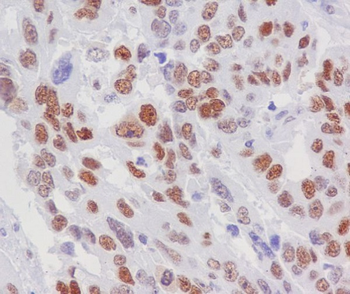 Retinoblastoma Rabbit mAb Antibody