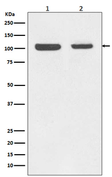 Retinoblastoma Rabbit mAb Antibody