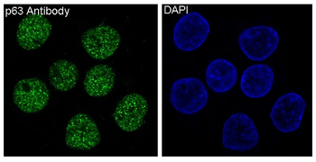 p63 Rabbit mAb Antibody