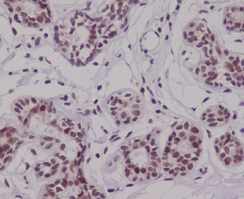 p63 Rabbit mAb Antibody