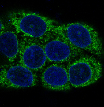 NSE Rabbit mAb Antibody