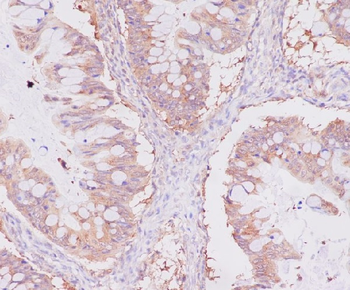 NSE Rabbit mAb Antibody