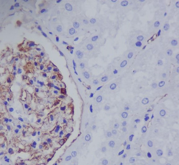 Nestin Rabbit mAb Antibody