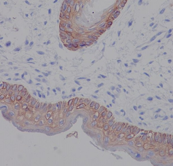 Cytokeratin 5 Rabbit mAb Antibody