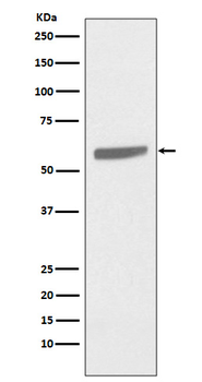 Cytokeratin 5 Rabbit mAb Antibody