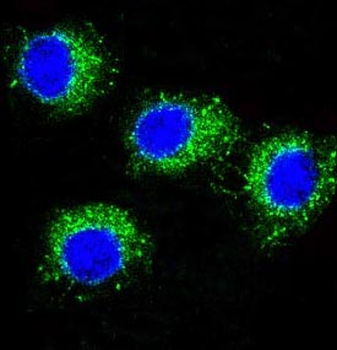 NALP3 Rabbit mAb Antibody