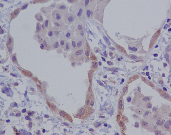 NALP3 Rabbit mAb Antibody