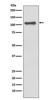 NALP3 Rabbit mAb Antibody