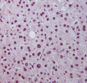 Hes1 Rabbit mAb Antibody