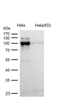 Catenin alpha 1 Rabbit mAb [KD Validated]