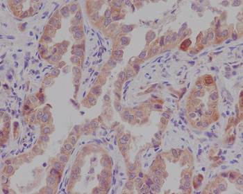 Catenin alpha 1 Rabbit mAb [KD Validated]
