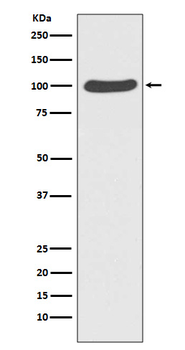 Catenin alpha 1 Rabbit mAb [KD Validated]