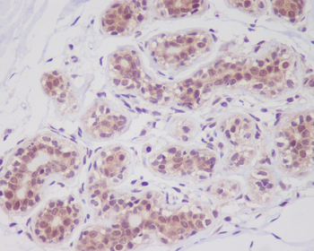 Cortactin Rabbit mAb Antibody