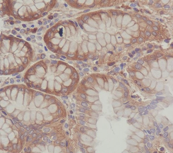 SCF Rabbit mAb Antibody