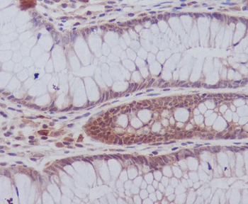 PYK2 Rabbit mAb Antibody
