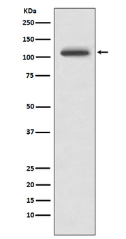 PYK2 Rabbit mAb Antibody