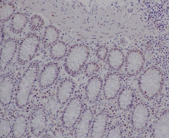 Ku80 Rabbit mAb Antibody