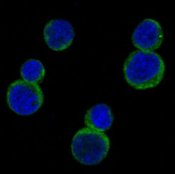 Rho A Rabbit mAb Antibody