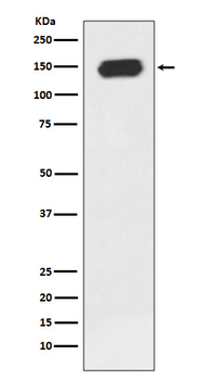 PLC gamma 1 Rabbit mAb Antibody