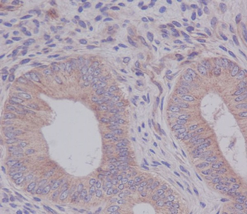 eIF5A Rabbit mAb