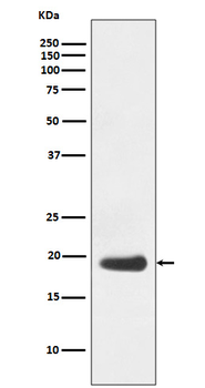 eIF5A Rabbit mAb