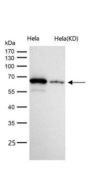 Chk2 Rabbit mAb [KD Validated] Antibody