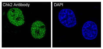 Chk2 Rabbit mAb [KD Validated]