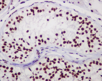 Chk2 Rabbit mAb [KD Validated]