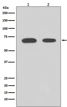 Chk2 Rabbit mAb [KD Validated]