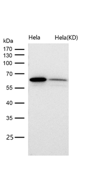 hnRNP K Rabbit mAb [KD Validated] Antibody