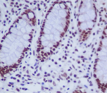 hnRNP K Rabbit mAb [KD Validated] Antibody