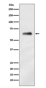 hnRNP K Rabbit mAb [KD Validated] Antibody