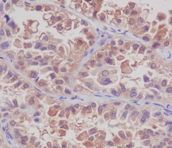 MSI2 Rabbit mAb Antibody