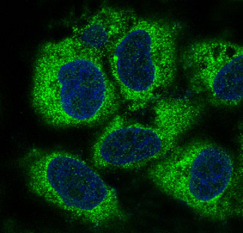 PEBP1 Rabbit mAb Antibody