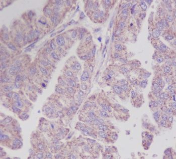 PEBP1 Rabbit mAb Antibody