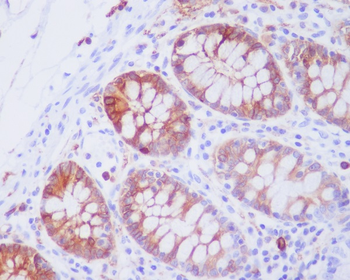 JNK2 Rabbit mAb Antibody