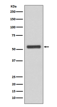 JNK2 Rabbit mAb