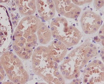 STK3 Rabbit mAb Antibody