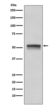 Chk1 Rabbit mAb Antibody