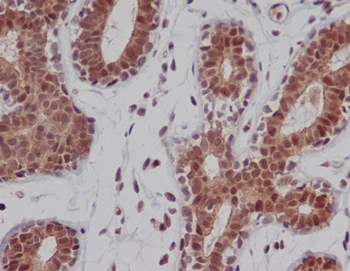 DNA-PKcs Rabbit mAb [KD Validated]