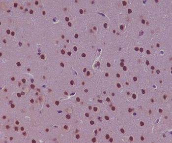 p73 Rabbit mAb Antibody