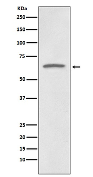 p73 Rabbit mAb Antibody
