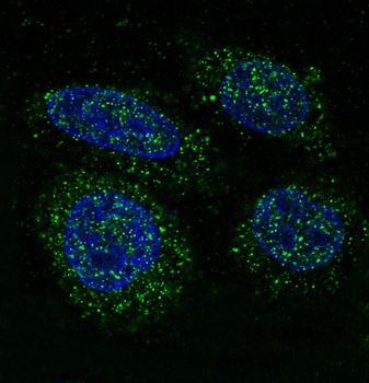 FGFR1 Rabbit mAb Antibody