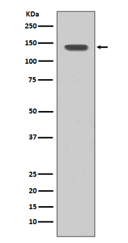 FGFR1 Rabbit mAb Antibody