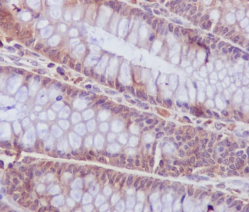 Caspase-6 Rabbit mAb
