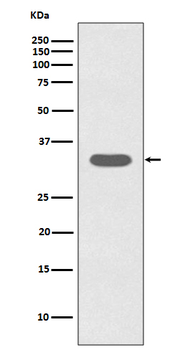 Caspase-6 Rabbit mAb
