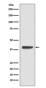 Islet 1 Rabbit Monoclonal Antibody