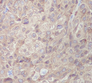 MLANA Rabbit mAb Antibody