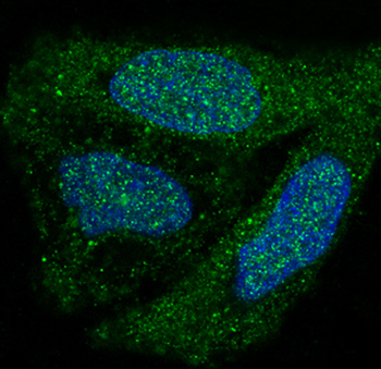p38 MAPK Rabbit mAb [KD Validated]