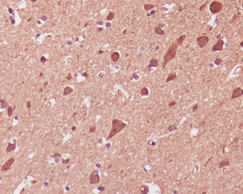 p38 MAPK Rabbit mAb [KD Validated]